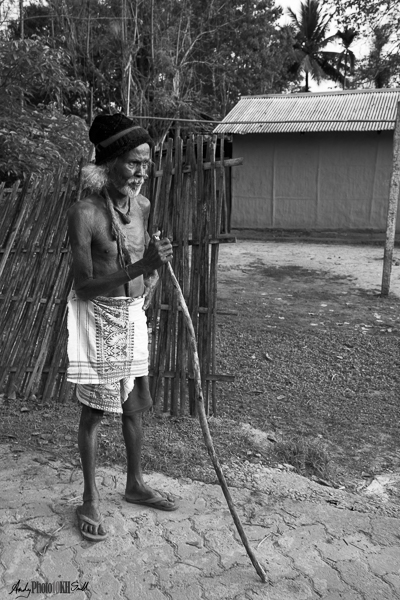 Emaciated Man Assam
